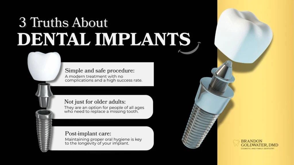 Shine Brighter with Dental Implants.